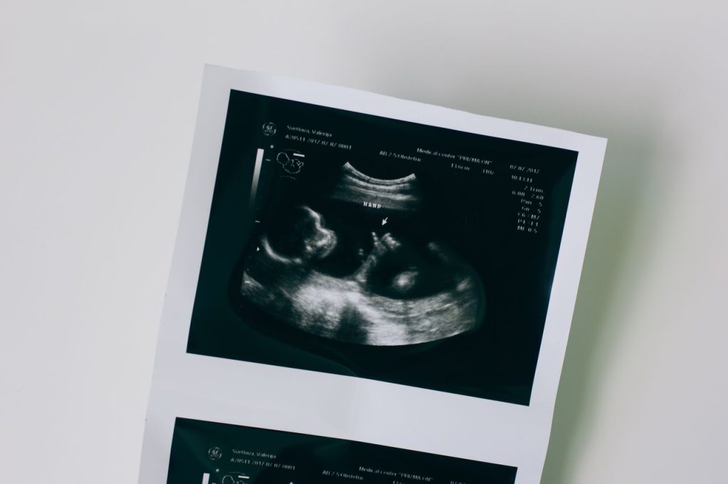 ultrasound